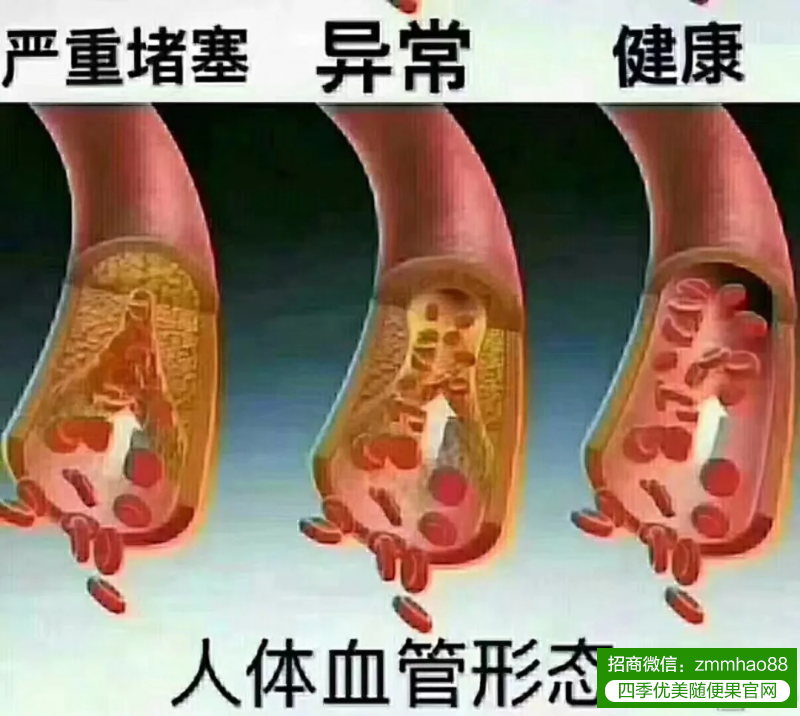 内脏脂肪有什么危害，随便果如何排毒，调理亚健康