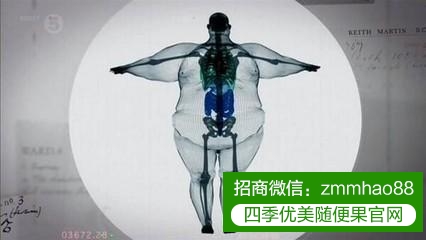 六种肥胖人群的类型，看看你是哪一种